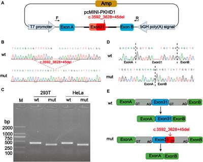 Pathogenic relationship between phenotypes of ARPKD and novel compound heterozygous mutations of PKHD1